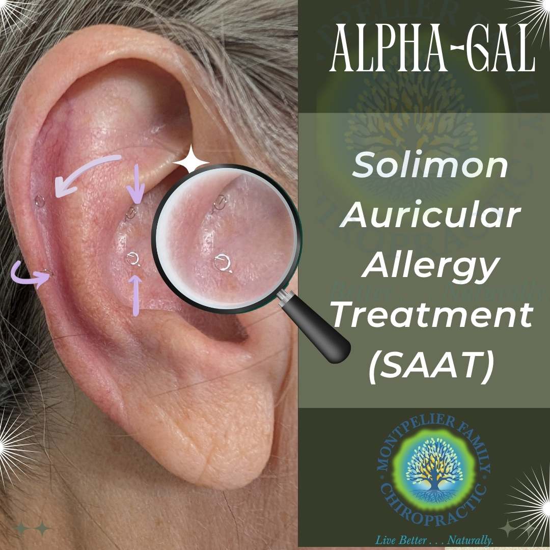 MCAS (Mast Cell Activation Syndrome) Treatment with the SAAT Technique in Montpelier, VA 